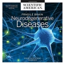 Fragile Brain: Neurodegenerative Diseases by Scientific American